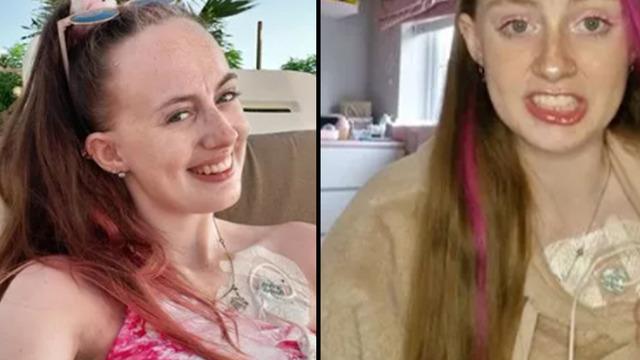 8 yılı aşkın süredir hiçbir şey yemiyor! Nadir görülen hastalığını anlatınca sosyal medyayı şaşırttı:  Kalbimden besleniyorum