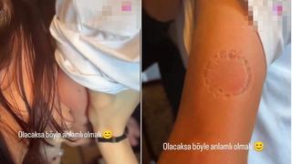 'Sonunda bu da oldu' dedirtti! Sevgilisinin ısırık izini koluna dövme yaptırdı... Sosyal medyadan yorum yağdı