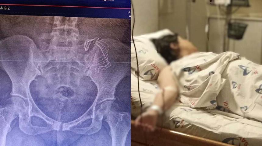 Yer: Sultanbeyli! Doğumda vücudunda unutuldu, 10 ay sonra fark ettiler! Talihsiz kadın "Ölümden döndüm" diyerek anlattı