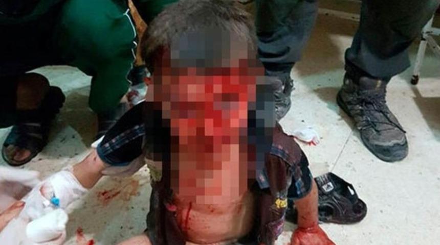 PKK hesapları harekete ge&ccedil;ti! Kara propagandaya başladılar