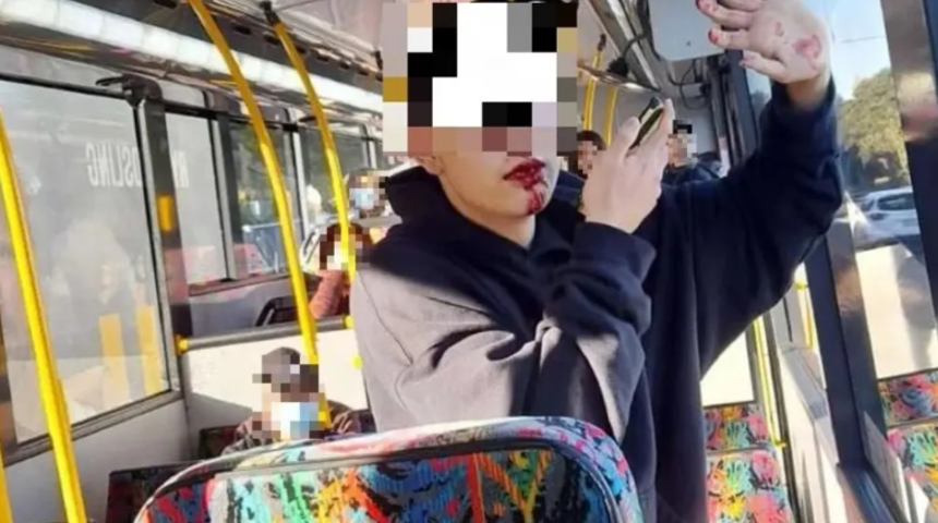 Halk otobüsünde korkunç saldırı! 16 yaşındaki genç kıza demir sopayla vurup 5 dişini kırdı... "Acıdan titrediğini fark ettim"