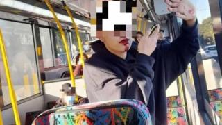 Halk otobüsünde korkunç saldırı! 16 yaşındaki genç kıza demir sopayla vurup 5 dişini kırdı... Acıdan titrediğini fark ettim