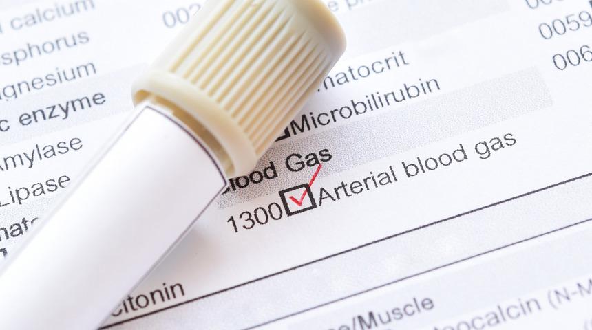 Kan gazı nedir, neden istenir? Kan gazı yükselirse ne olur, düşüklüğü ne anlama gelir?