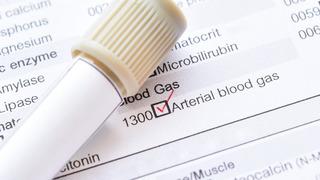 Kan gazı nedir, neden istenir? Kan gazı yükselirse ne olur, düşüklüğü ne anlama gelir?