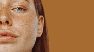 Çillerinden kurtulmak istiyorsan bu 3 şeyi yap! 