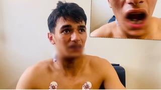 Pendik'te kan donduran olay! 18 yaşındaki genç sadece yolda yürüyordu: Şimdi bu halde...