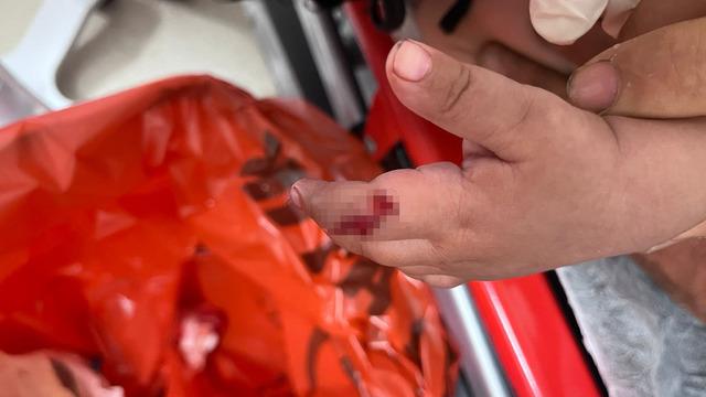 1 yaşındaki bebeğe vantilatör faciası: Uzmanlar uyardı: “1 ayda 4-5 hastamız oldu”