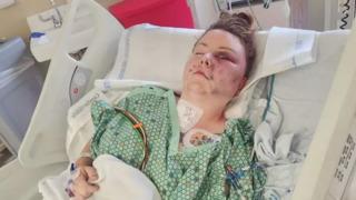 Cani koca cinnet getirdi! 9 yerinden bıçakladığı karısını çocuklarının gözü önünde benzin dökerek diri diri yakmaya çalıştı