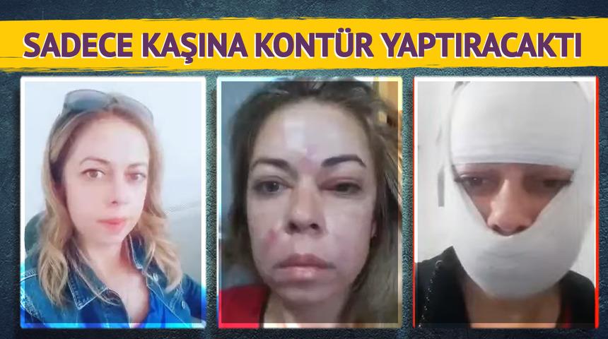 Ankara'daki estetik merkezinde hayatı karardı! Arkadaş tavsiyesi üzerine yüzü tanınmayacak hale geldi