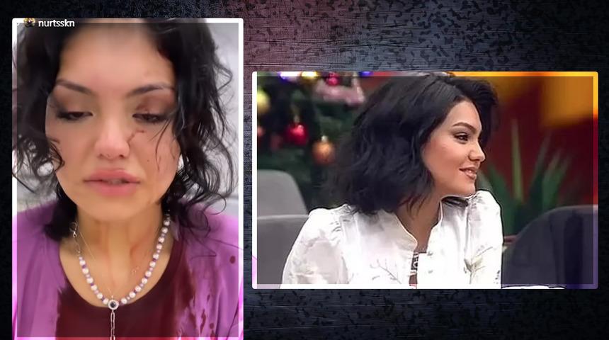 Kısmetse Olur yarışmacısı Eslem Sena Nur'a 3 kadın saldırdı! "Kafama çakı sokup merdivenden aşağı attılar"