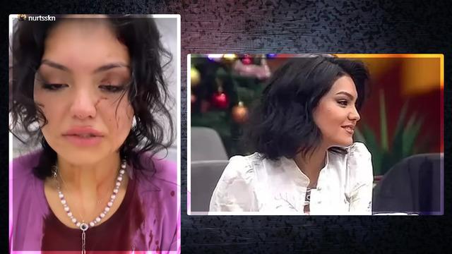 Kısmetse Olur yarışmacısı Eslem Sena Nur'a 3 kadın saldırdı! Kafama çakı sokup merdivenden aşağı attılar