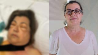 Dünyada sadece 3 örneği vardı... Türkiye'de ilk kez görülen vaka literatüre girecek! Basit bir kusma canını alıyordu