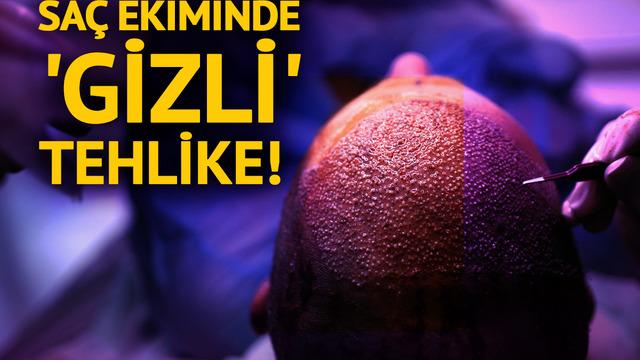 Saç ekiminde 'gizli' tehlike! Gençlerde daha ölümcül, daha kötü sonuçlanıyor”