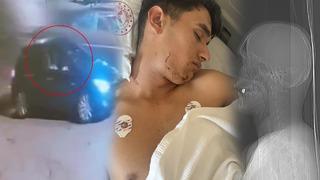 İstanbul'da mermi boynundan girmiş ağzında kalmıştı! Yanlış kişi tutuklanmış