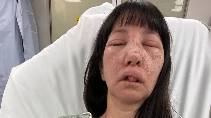 Ev temizliği sırada kabusu yaşadı! Örümcek sürüsünün saldırısına uğradı... "Gözümün yanında bir şey hissettim"