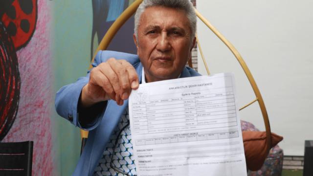 21 senede 27 kez anjiyo oldu! 74 yaşında öğrendiği gerçekle neye uğradığını şaşırdı: Hiçbir doktor söylemedi, çok geç kalındı