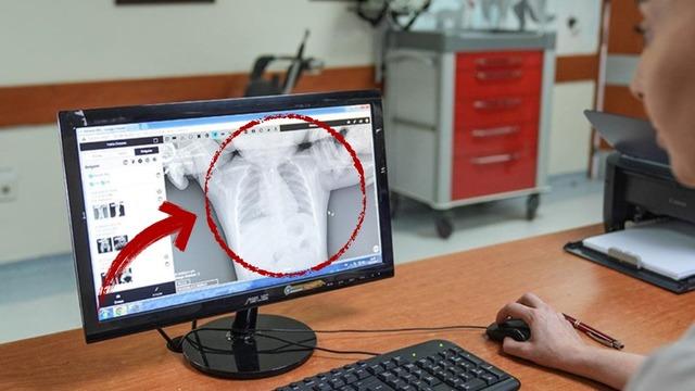 Ankara'da şoke eden olay! 10 aylık bebek aniden kusmaya başladı, ortaya çıkan gerçek yürekleri ağza getirdi