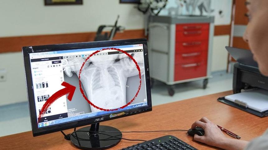 Ankara'da şoke eden olay! 10 aylık bebek aniden kusmaya başladı, ortaya çıkan gerçek yürekleri ağza getirdi