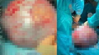 Hamile olduğunu düşünen kadın bebeğinin durumunu öğrenmek için hastaneye gitti! Gerçek çok farklı çıktı: Bebek değil tümörmüş