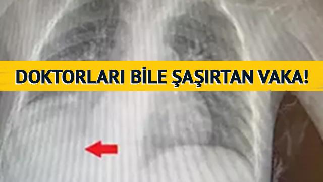 Doktorları bile şaşırtan vaka! Sürekli hastanelik oluyordu, gerçek 3 yıl sonra ortaya çıktı