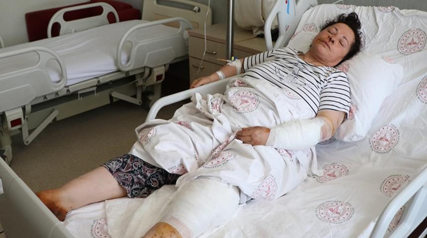 Niğde'de köpek saldırısı! 54 yaşındaki kadın dakikalarca mücadele etti