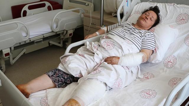 Niğde'de köpek saldırısı! 54 yaşındaki kadın dakikalarca mücadele etti