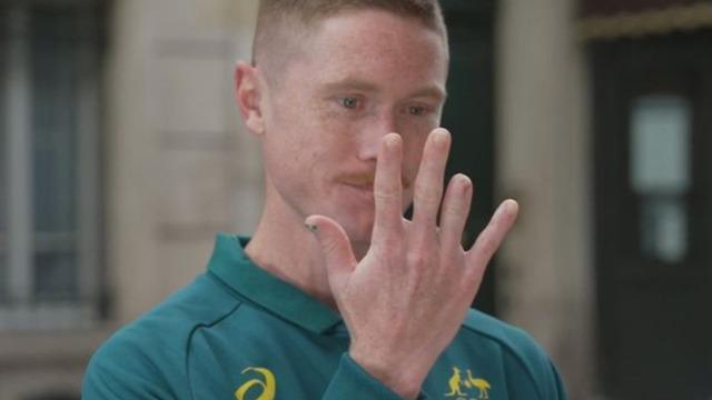 Paris Olimpiyatlarında oynayabilmek için parmağını kestirdi!