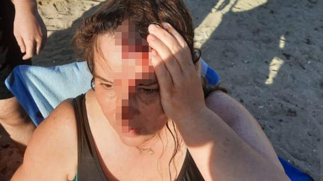 Yüzerken jet ski çarptı! Denizde kanlar içinde kaldı... Sebep olan kişi küfür edip kaçtı