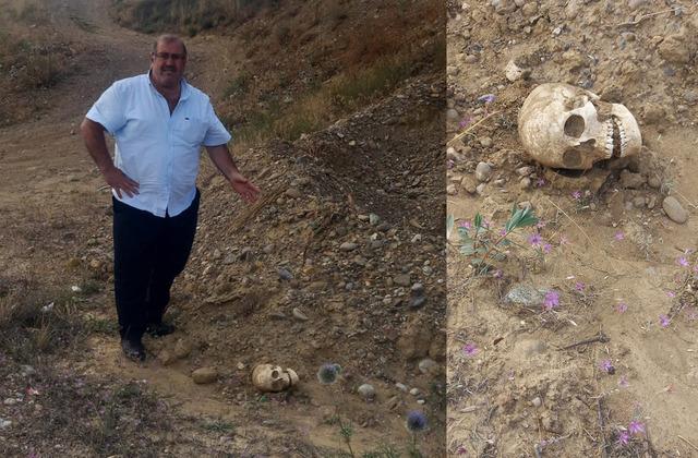 Gümüşhane’de gezintiye çıkan N.Z yol ortasında kafatası görmesiyle neye uğradığını bilemedi. Yağmur nedeniyle ortaya çıktığı düşünülen kafatasını bulan N.Z, olayı hemen polis ekiplerine bildirdi. 'X'te paylaş Bildirim ikonu1 640xauto