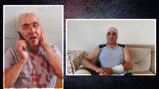 Yolcu, şoförün kafasını direksiyona vurup kulağını ısırarak kopardı! Kavganın sebebi ise tek bir kelime