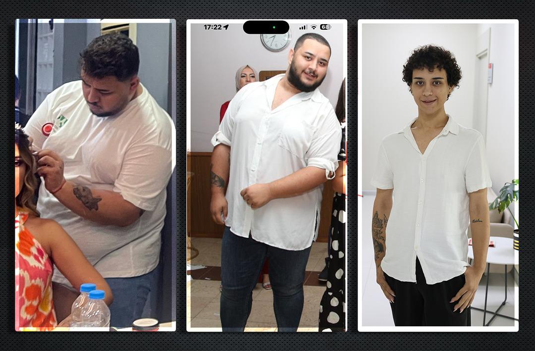 Herkesi şaşırtan değişim, 146 kilodan 72 kiloya d&uuml;şt&uuml;! Polis bile inanamayıp DNA testi yaptırdı 