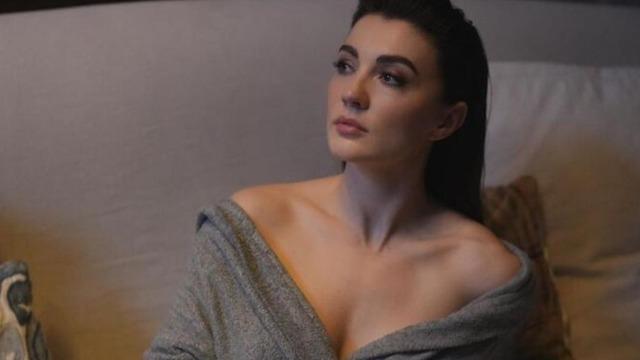 Herkes doğal güzel sanıyordu... Burcu Özberk'in estetiksiz hali ortaya çıktı 