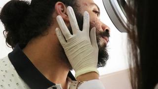 Sıcak havalar o hastalığı tetikledi: Vatandaş hastanenin yolunu tuttu! 'Oldukça bulaşıcı'