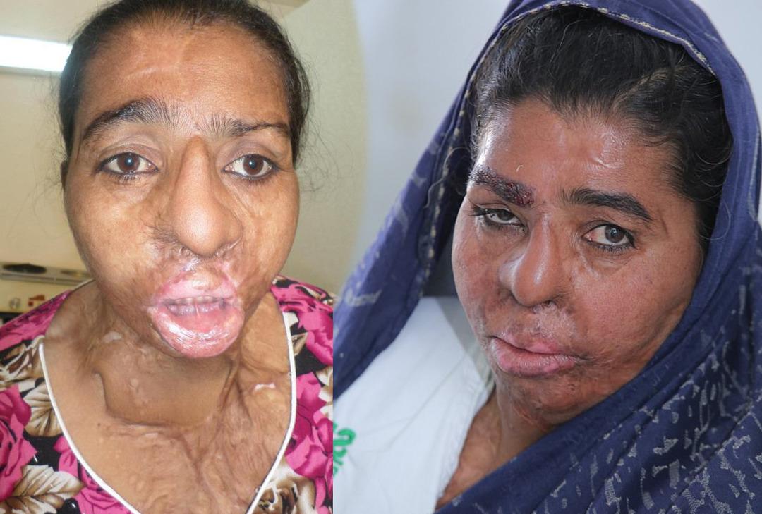 &Uuml;nl&uuml;lerin doktoru onların hayatını da değiştirdi