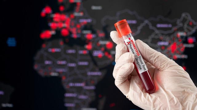 Yeni öldürücü hastalık varyantı kontrolsüzce yayılıyor! Uzmanlar uyarıyor: Yüz binlerce kişiyi etkileyebilir