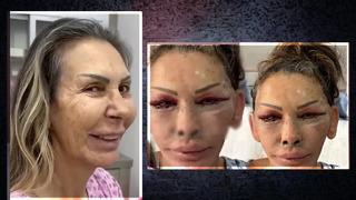 Petek Dinçöz'ün annesi yüzünü gerdirmişti! Esra Süay Toğuş'un son halini doktoru paylaştı... Ben eski beni unuttum