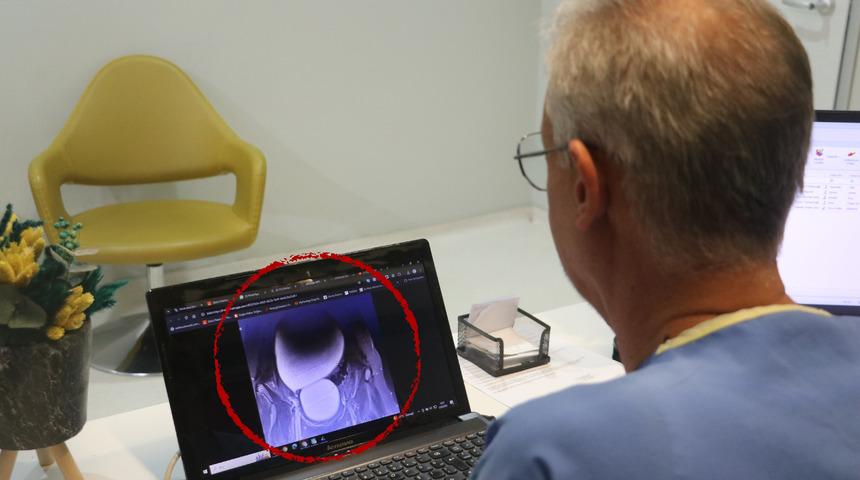 Basit bir ağrı sandı, doktorlar bile gözlerine inanamadı! 12 yaşındaki kızın karnından çıktı