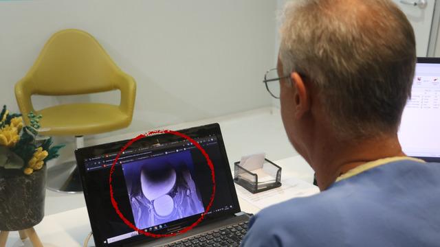 Basit bir ağrı sandı, doktorlar bile gözlerine inanamadı! 12 yaşındaki kızın karnından çıktı