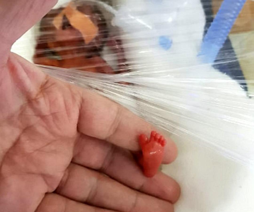 Birka&ccedil; saat i&ccedil;inde &ouml;l&uuml;r dediler ama onlar umudunu hi&ccedil; kaybetmedi