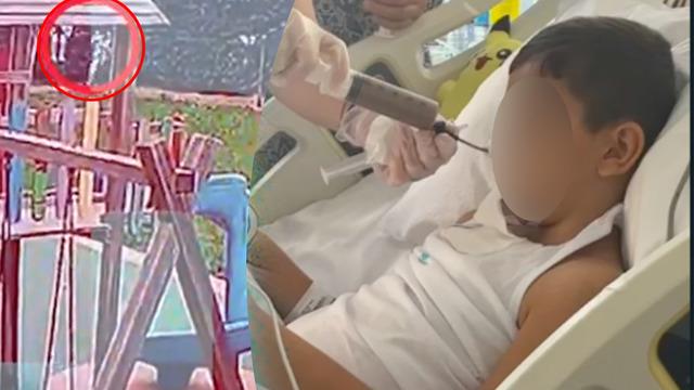 Özel okulun bahçesinde oynarken çenesi koptu, 'kötü tesadüf' raporu isyan ettirdi: Herhalde tüm dosyalarda ‘kader’ deyip kusursuzluk tespiti yapıyorlar