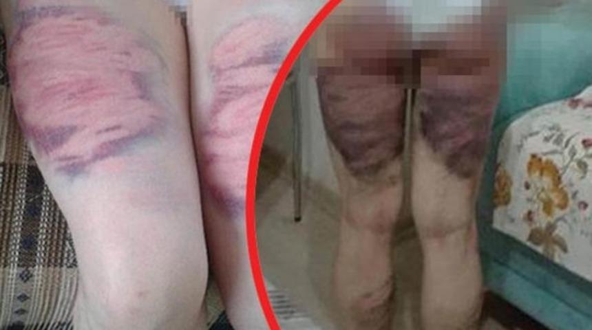 Savunması şoke etti: Vurmuş olabilirim, ama darp etmedim