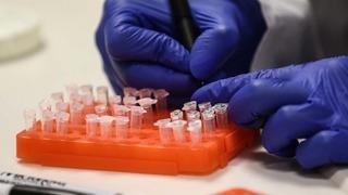 SON DAKİKA | Türkiye'de rastlandı mı? Kısıtlama gelecek mi? Sağlık Bakanlığı'ndan 'M çiçeği (mpox) hastalığı' açıklaması! DSÖ maymun çiçeği nedeniyle acil durum ilan etmişti