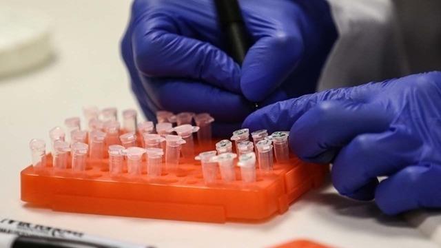 SON DAKİKA | Türkiye'de rastlandı mı? Kısıtlama gelecek mi? Sağlık Bakanlığı'ndan 'M çiçeği (mpox) hastalığı' açıklaması! DSÖ maymun çiçeği nedeniyle acil durum ilan etmişti