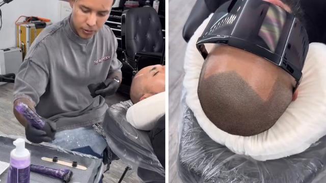 Saç ektirmek yerine dövme yaptırdı! Bir gören bir daha baktı... Bulduğu yöntem şaşkına çevirdi 