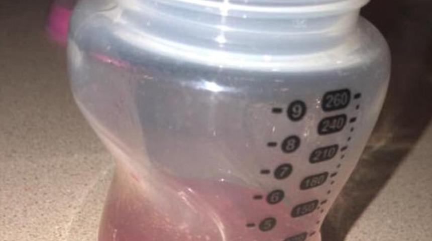 Onu yedi... Hem idrarı hem s&uuml;t&uuml; pembe akmaya başladı