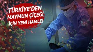 Eskisinden daha ölümcül! Türkiye'den M-Çiçeği (MPOX) için yeni hamle geldi: Aynı evi paylaşanların teması risk oluşturuyor