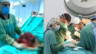 Yıllardır karın ağrısı çekiyordu! 10 kilo ağırlığında, 30 santimetre çapında…Çocuk sahibi olamamasının sebebi buymuş
