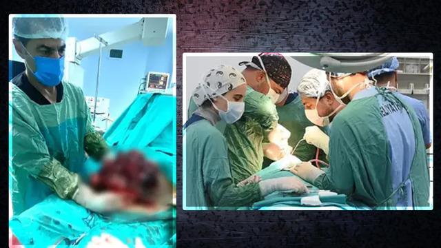 Yıllarca karnında taşımış! Tam 10 kilo... Karın ağrısı şikayetiyle hastaneye gitmese fark etmeyecekti