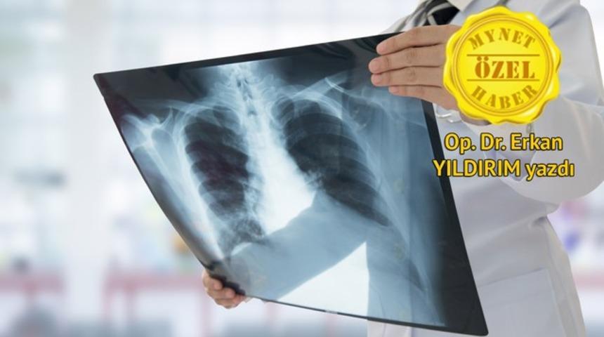 Akciğerde sıvı toplanmasına akciğer kateteri (IPC) uygulaması