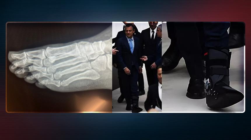 'Vuruldu' iddiasına tepki! CHP lideri Özel ayağının nasıl kırıldığını açıkladı, filmleri ortaya çıktı: Parmaklarında kırıklar var